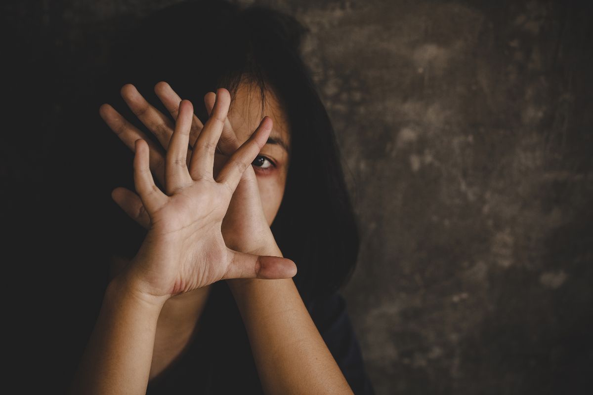 A woman with a bruised face holds her hands up in fear.